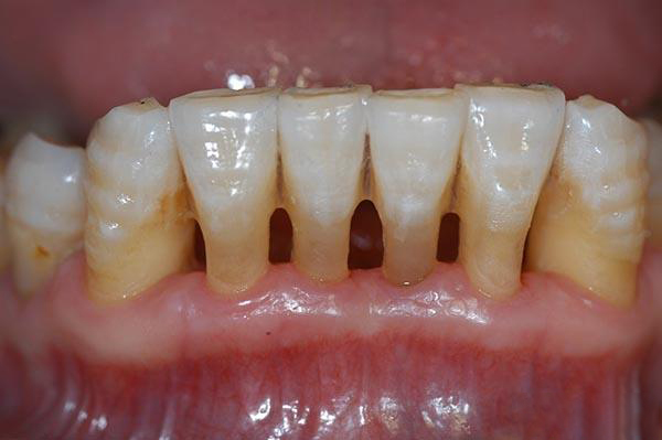 资阳最新24小时牙医在线咨询方法分析(最方便真实的资阳有没有24小时牙医方法)